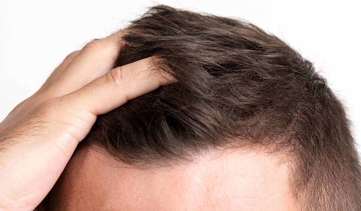 Tratamientos de Pérdida de Cabello en el Extranjero