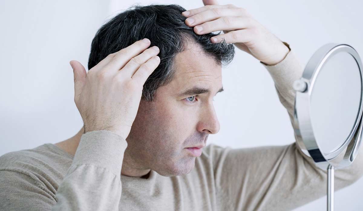 Prevención de la Caída de Cabello en Panamá