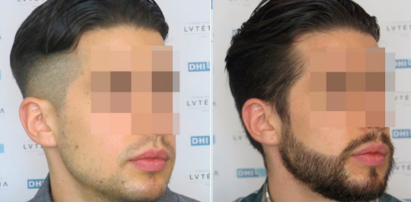barba-1-1