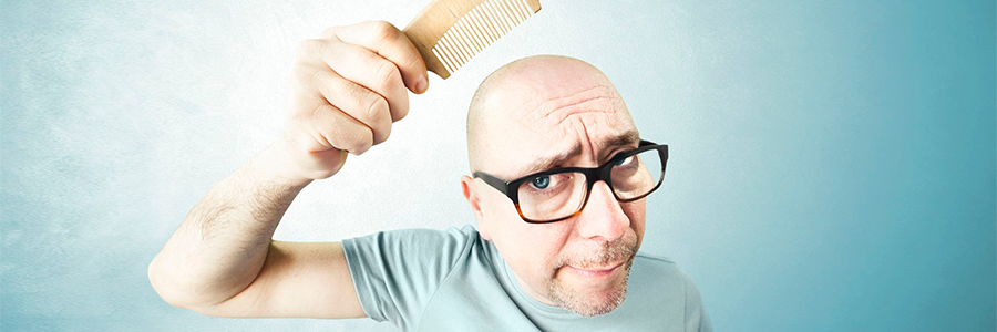 Sufriendo en silencio por la perdida de cabello