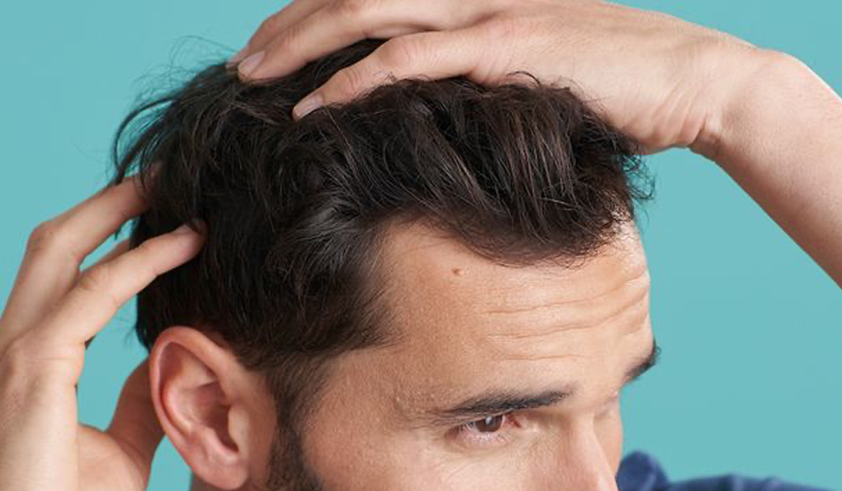 trasplante de cabello durante el covid-19