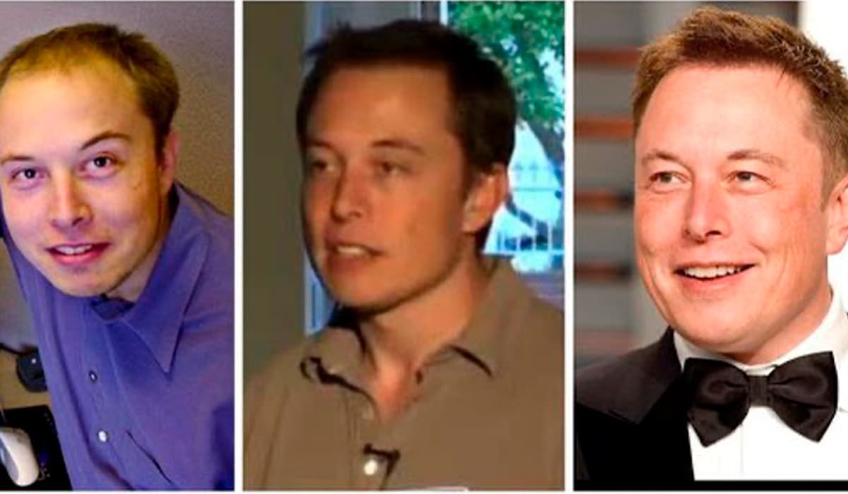 El Secreto del Cabello de Elon Musk