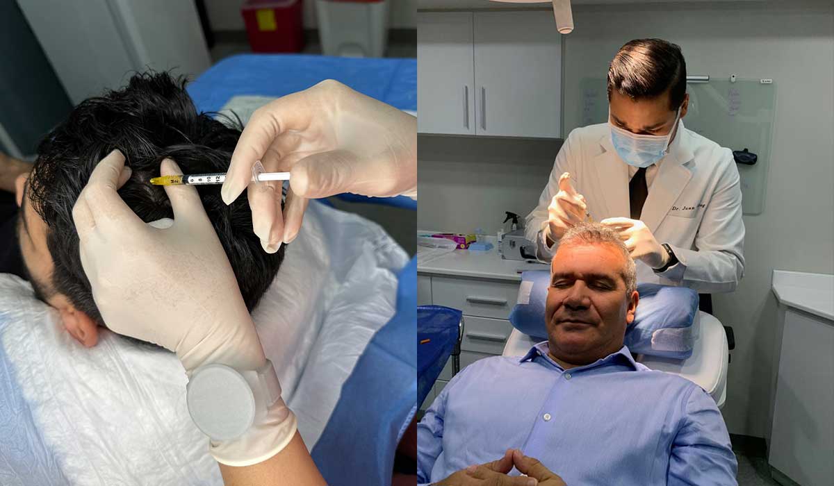 Terapias Capilares la opción preventiva a la perdida de cabello
