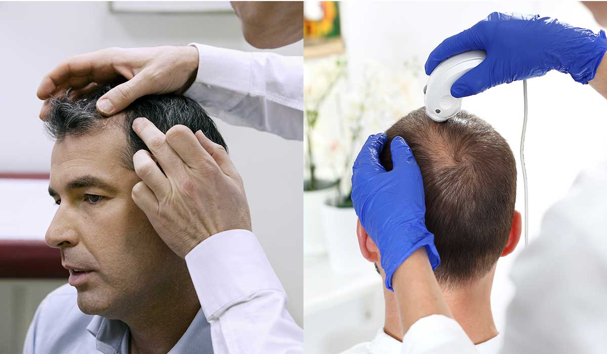 Detén la Caída del Cabello: Implante Capilar