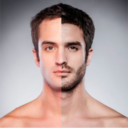 Facial Hair Restoration in New Jersey