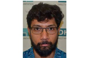 1 trasplante de barba