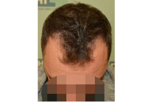 frente-up-0458