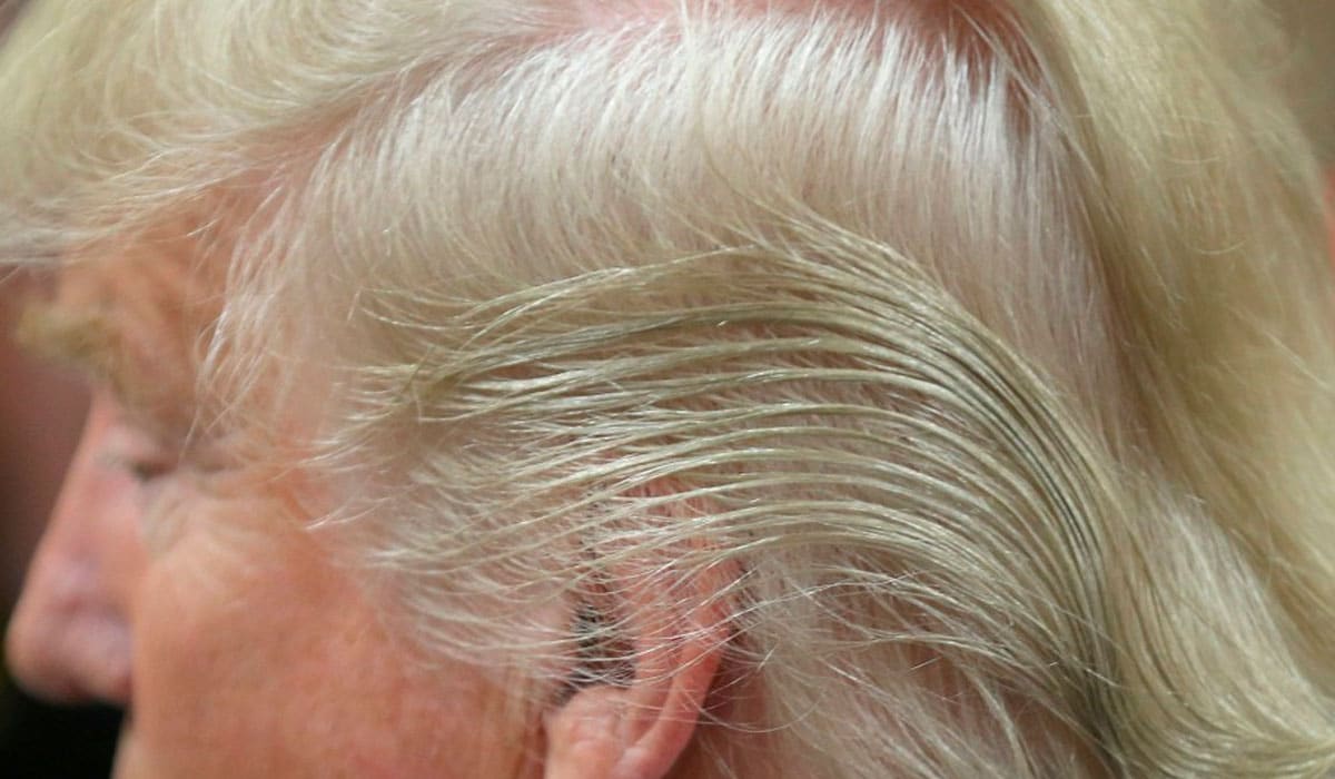 Efectos secundarios del Finasteride