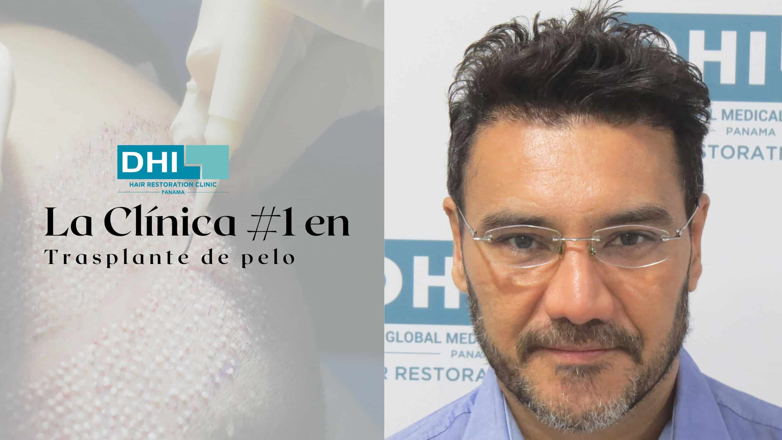 La Clínica #1 en Trasplante de pelo