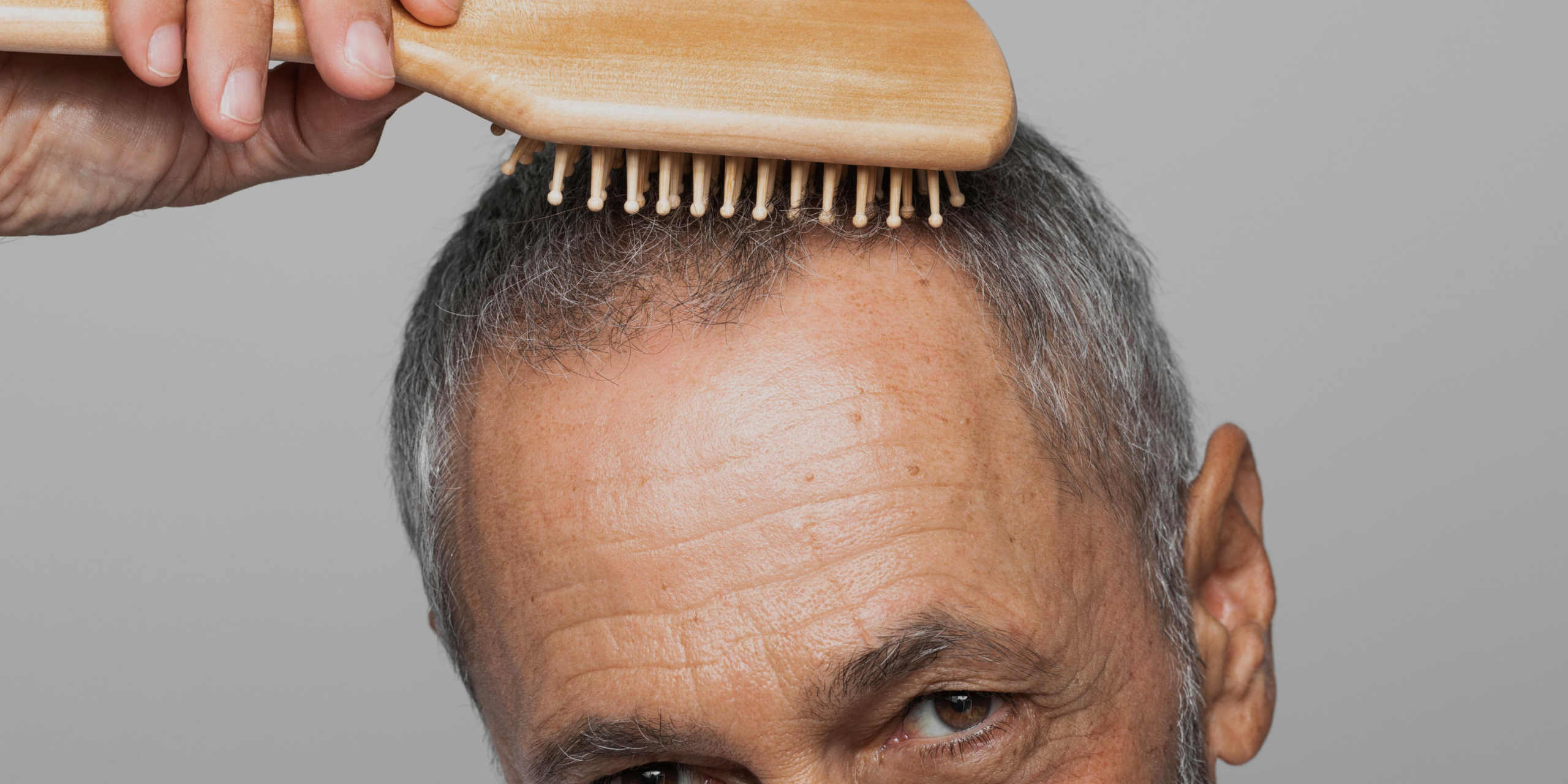 Causas de caída del cabello