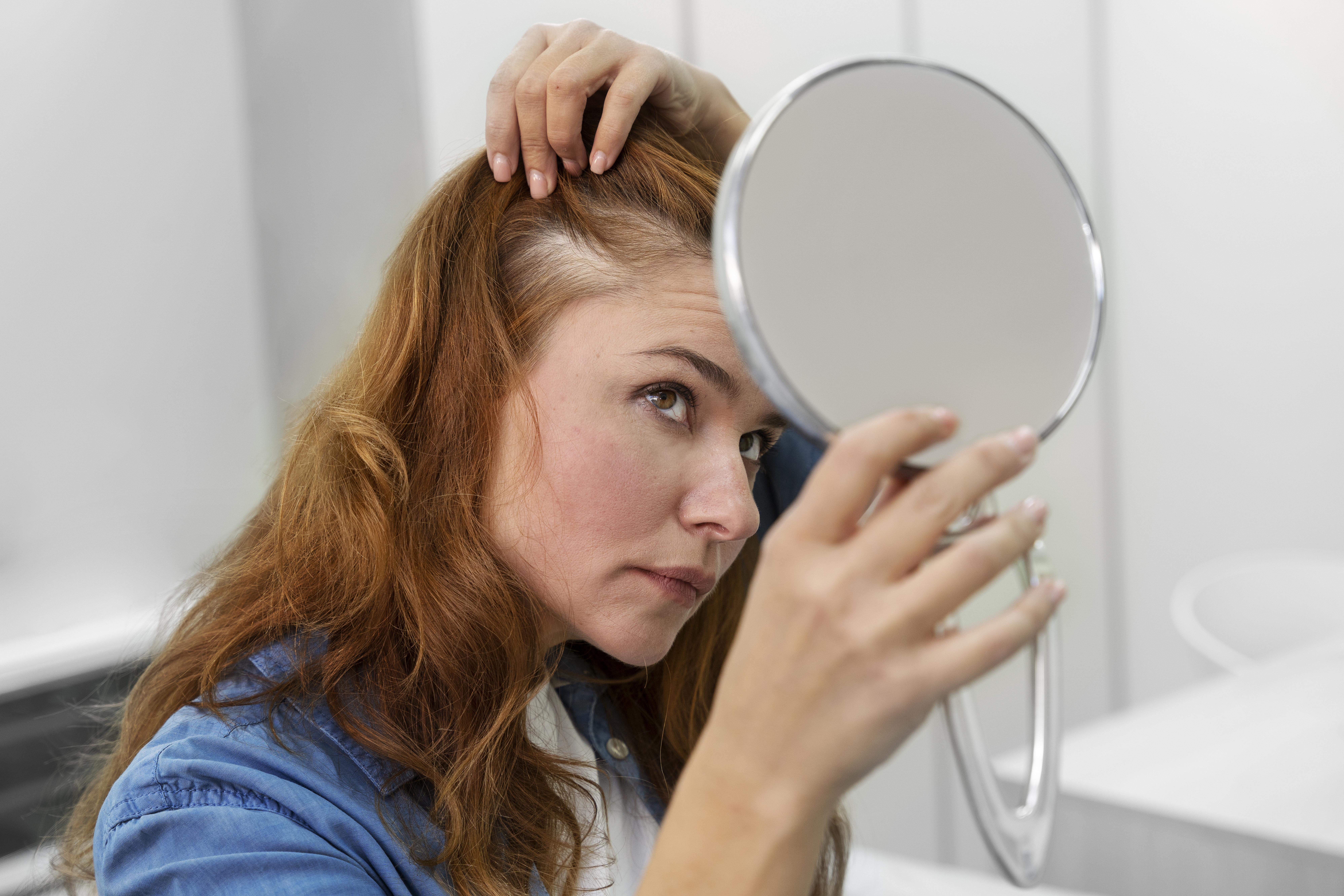 alopecia femenina en Panamá